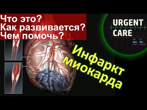 Видео: Инфаркт миокарда