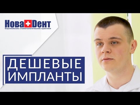 Видео: 💲 Сколько стоят зубные импланты, и от чего зависит цена. Сколько стоят зубные импланты. 12+