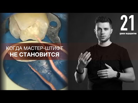Видео: Уроки эндодонтии. Когда не становится мастер-штифт
