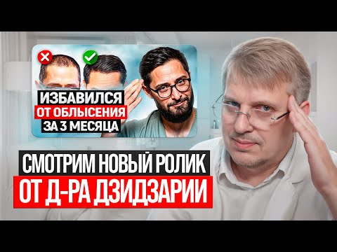 Видео: Смотрим новый ролик от д-ра Дзидзарии о выпадении волос