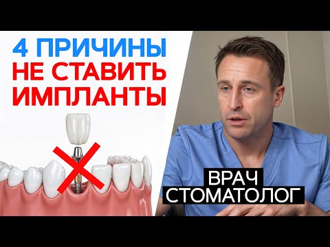 Видео: Главные минусы имплантов! / Реальные истории от пациентов