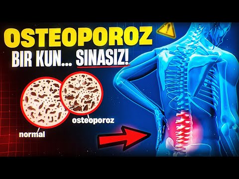 Видео: Остеопороз – Бир кун... синасиз! | Доктор Гулбаҳор