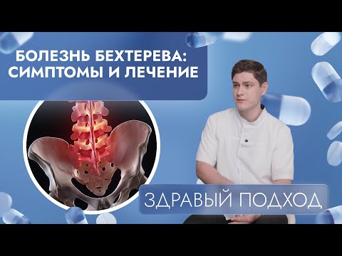 Видео: Болезнь Бехтерева: симптомы и лечение | Здравый подход (2025)
