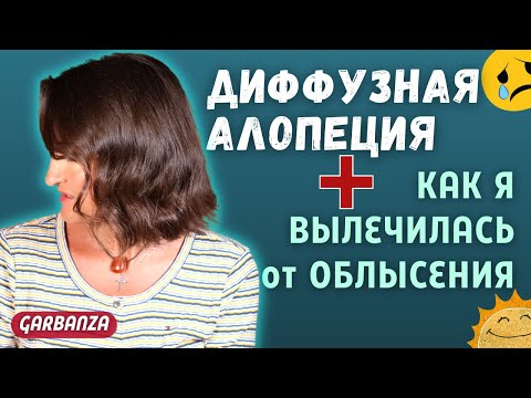 Видео: Диффузная алопеция. Лечение выпадения волос