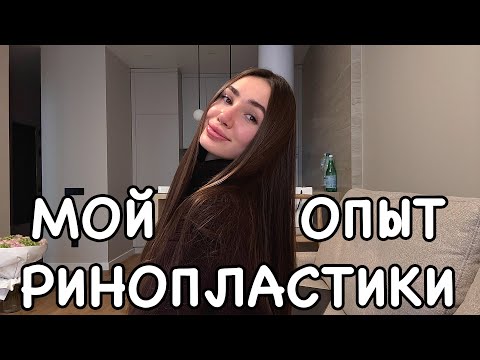 Видео: МОЙ опыт РИНОПЛАСТИКИ? минусы ринопластики, как выбрать хирурга, реабилитация