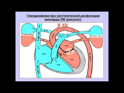 Видео: УЗД систолической дисфункции ЛЖ Моргунов М Н