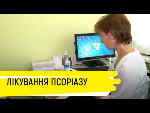 Видео: Черкаські медики розповіли, як лікувати псоріаз