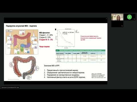 Видео: Опухоли ЖКТ (вебинар 12 февраля 2024)