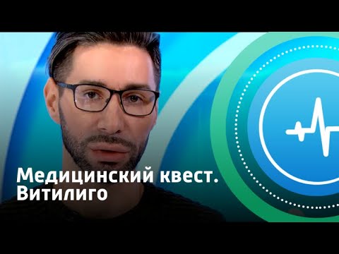 Видео: Медицинский квест. Витилиго | Телеканал «Доктор»