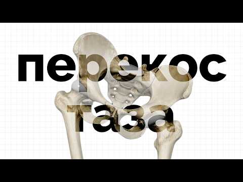 Видео: Перекосило таз? Делай простое упражнение!