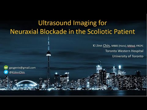 Видео: Ультразвуковая визуализация при нейроаксиальной блокаде / Люмбальная пункция при сколиозе