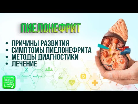 Видео: Пиелонефрит | Всегда ли сопровождается болью?