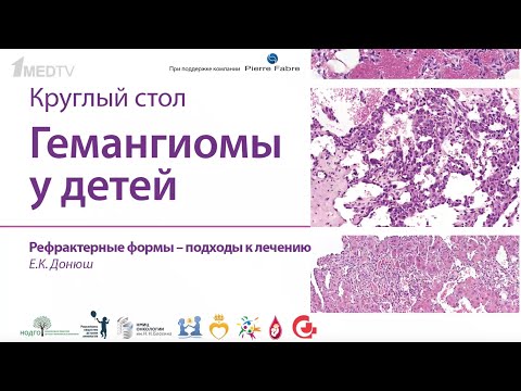 Видео: Донюш Е.К. "Рефрактерные формы - подходы к лечению"
