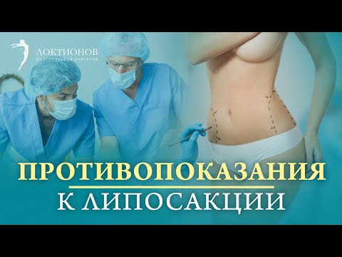 Видео: Когда нельзя делать липосакцию живота? Ограничения для проведения липосакции