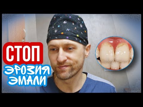 Видео: Эрозия Эмали