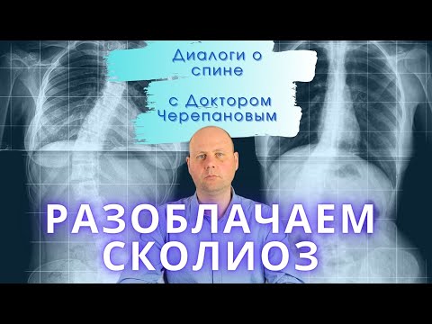 Видео: Сколиоз | Как отличить болезнь от плохой осанки? Как лечить сколиоз?