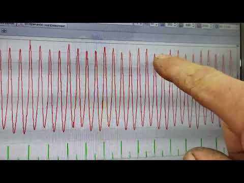 Видео: ЛАДА ГРАНТА FL 2024 ПОСЛЕ ТЮНИНГА ДВИГАТЕЛЯ ТРОИТ