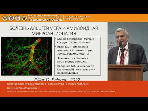 Видео: Камчатнов Павел Рудольфович Церебральная микроангиопатия – новый взгляд на старую проблему