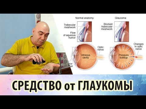 Видео: Причины возникновения глаукомы и рекомендации для её лечения и профилактики
