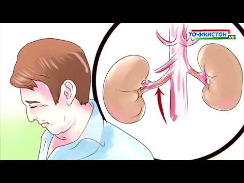 Видео: Солими бемории илтиюби гурда, пиелонефрит почки