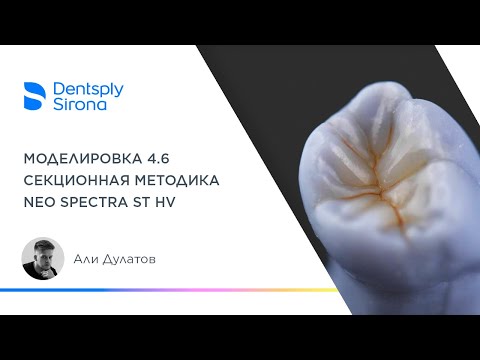 Видео: Моделировка 4.6 композитом Neo Spectra ST HV: секционная техника.