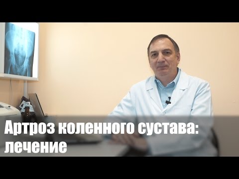 Видео: Лечение артроза коленного сустава. Гонартроз - симптомы, лечение и диета.