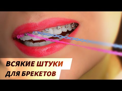 Видео: Инструменты ортодонта для брекетов. Дуги, пружинки, минивинты, кнопки, накладки, эластики, изгибы.