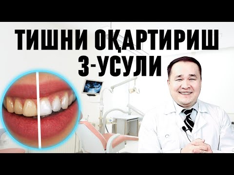 Видео: ТИШЛАРНИ ОҚАРТИРИШНИ 3 СИНАЛГАН УСУЛИ, УЙ ШАРОИТИДА ТИШЛАРНИ ОППОҚ ҚОРДЕК ҚИЛИНГ