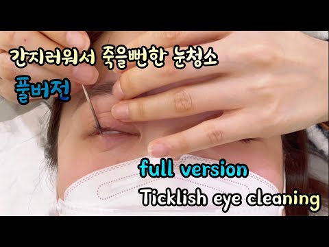 Видео: полная версия зуд очищения глаз/full version of itchy eye cleaning
