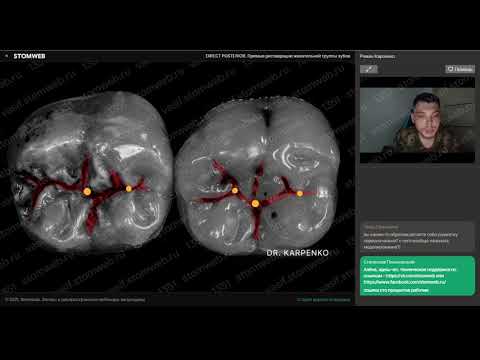 Видео: Роман Карпенко - DIRECT POSTERIOR. Прямые реставрации жевательной группы зубов