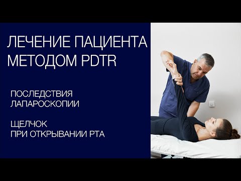 Видео: Лапароскопия - последствия.  Щелчок в челюсти.  Лечение реального  пациента методом PDTR