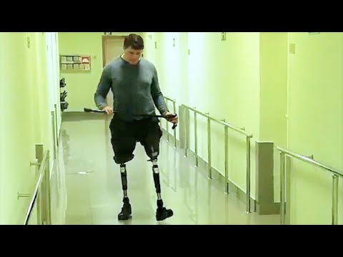 Видео: При парной (двусторонней) ампутации бедра, ходят на протезах и даже бегают