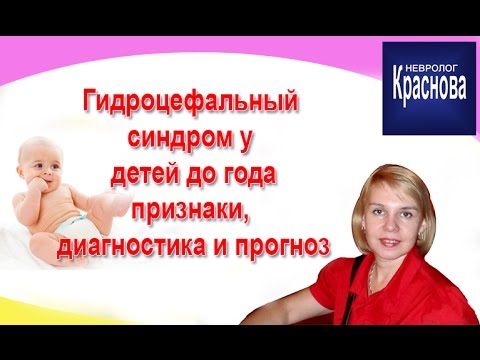 Видео: Гидроцефальный  синдром у  детей до года признаки,  диагностика и прогноз. Доктор Краснова