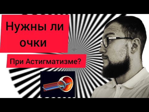 Видео: Астигматизм - нужно ли его учитывать в оптической коррекции?
