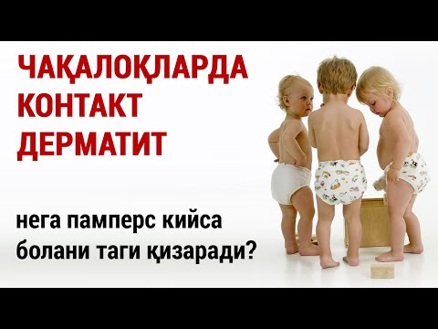 Видео: Чақалоқларда контакт дерматит. Нега памперс кийса болани таги қизаради?
