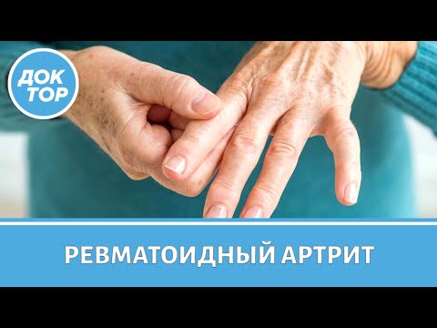 Видео: Как жить с ревматоидным артритом