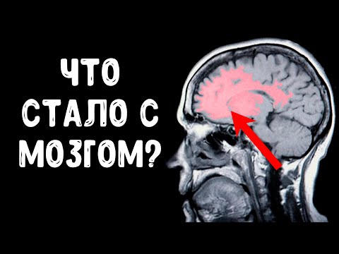 Видео: Выпил 25 банок энергетика за ночь, что стало с мозгом?