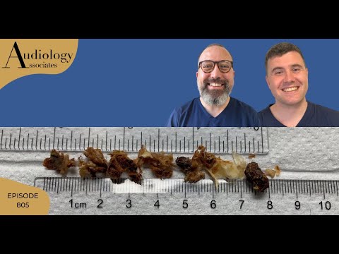 Видео: Набор для удаления ушной серы, включая очистку сосцевидной полости - EP805