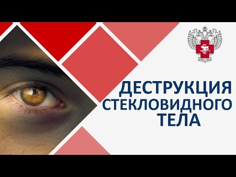 Видео: Деструкция стекловидного тела лечение. 👓 Лазерное лечение деструкции стекловидного тела. 12+