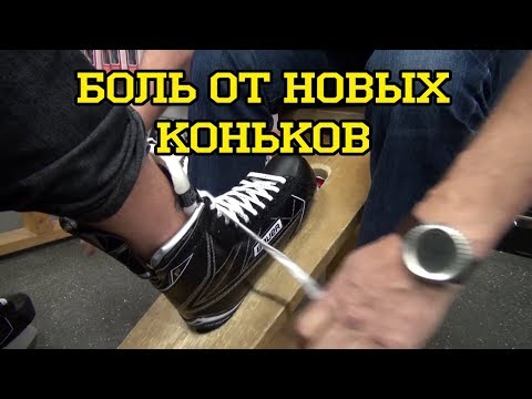 Видео: Боль от новых коньков: Термо формовка коньков . New Skate Prep: Why you Should Bake New Skates