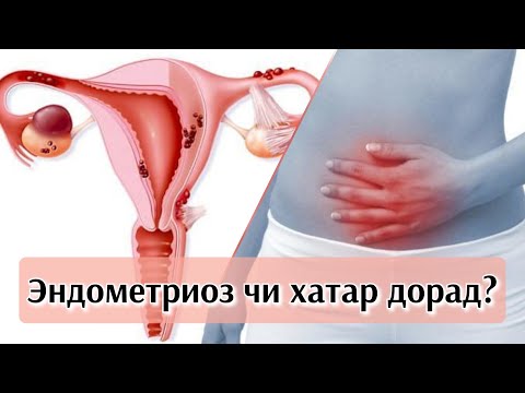Видео: Эндометриоз, аденомиоз, методы профилактики и лечения. #эндометриоз #аденомиоз #здороваяжизнь