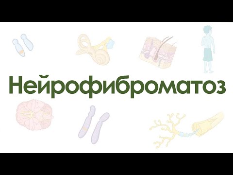 Видео: Нейрофиброматоз