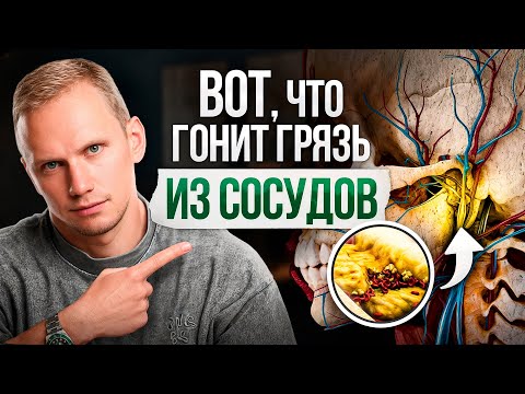 Видео: ЭТО почистит сосуды лучше, чем щетка! ЧИСТКА СОСУДОВ