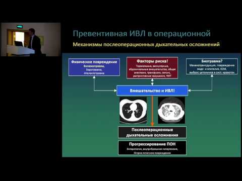 Видео: Протективная ИВЛ во время вмешательств – что может анестезиолог? 27.05.17 Кузьков В.В.
