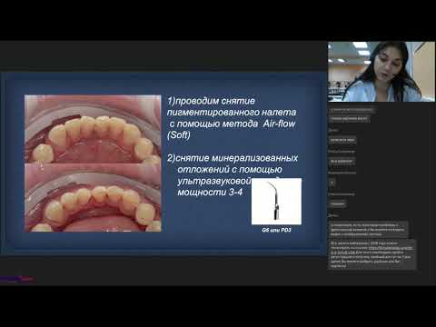 Видео: "Принципы алгоритма при проведении профессиональной гигиены."(13.08.2019)
