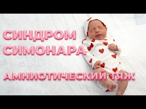 Видео: НАША ИСТОРИЯ! Я СМОГЛА И ТЫ СМОЖЕШЬ! Амниотический тяж или синдром Симонара