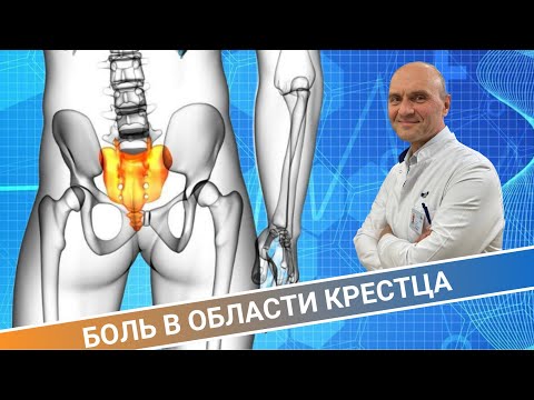 Видео: БОЛЬ В ОБЛАСТИ КРЕСТЦА И КОПЧИКА