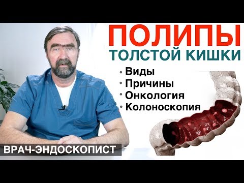 Видео: ПОЛИПЫ ТОЛСТОЙ КИШКИ - причины появления полипов, симптомы полипов, диагностика полипов в кишечнике