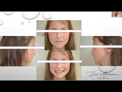 Видео: Последователи на дисциплината "Алекзандър" - епизод 6: д-р Инна Атанасова