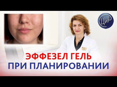 Видео: Лечение акне и Эффезел гель при планировании беременности. Дементьева С.Н.